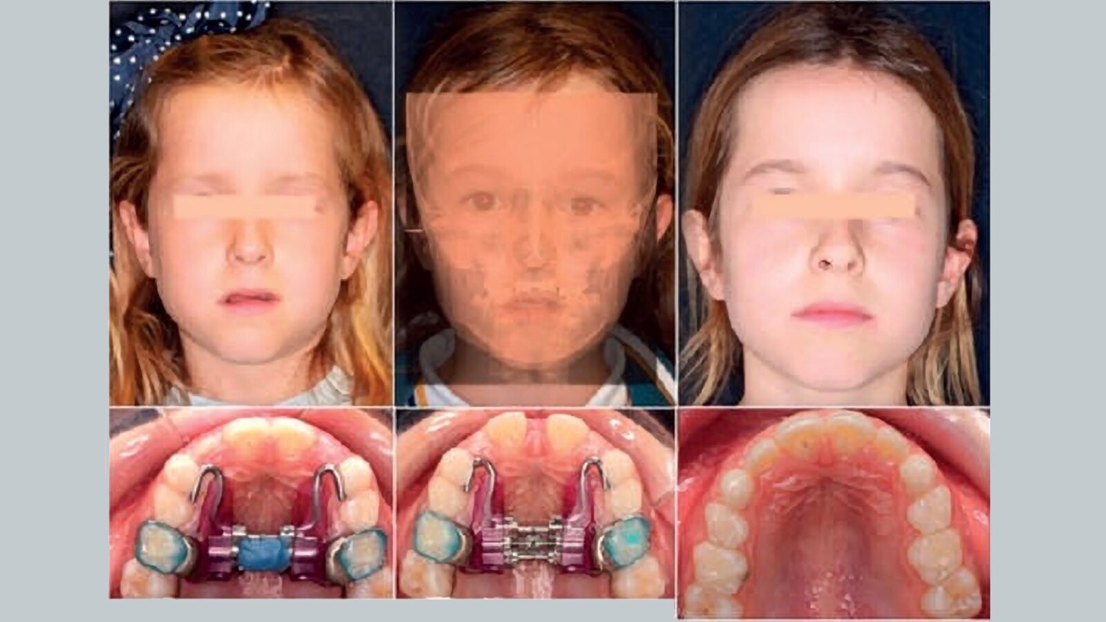 Nuevas Tecnologías y Técnicas en Ortodoncia y Ortopedia Dentofacial Digital
