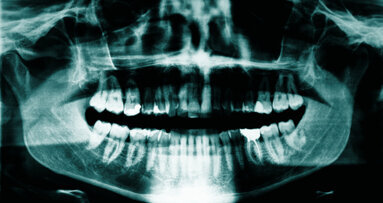 Voedingsstoffen stimuleren botvorming