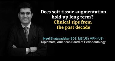 Does soft tissue augmentation hold up long term? Clinical tips from the past decade