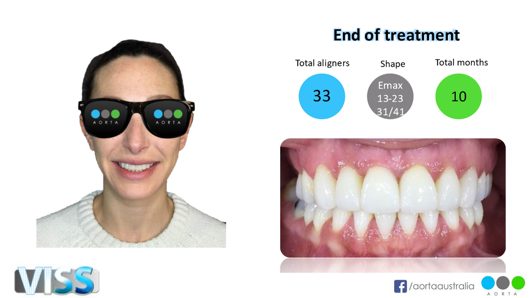 Fig. 37: Patient’s facial photograph after restoration and tooth whitening, alongside a close-up view of the patient’s smile.