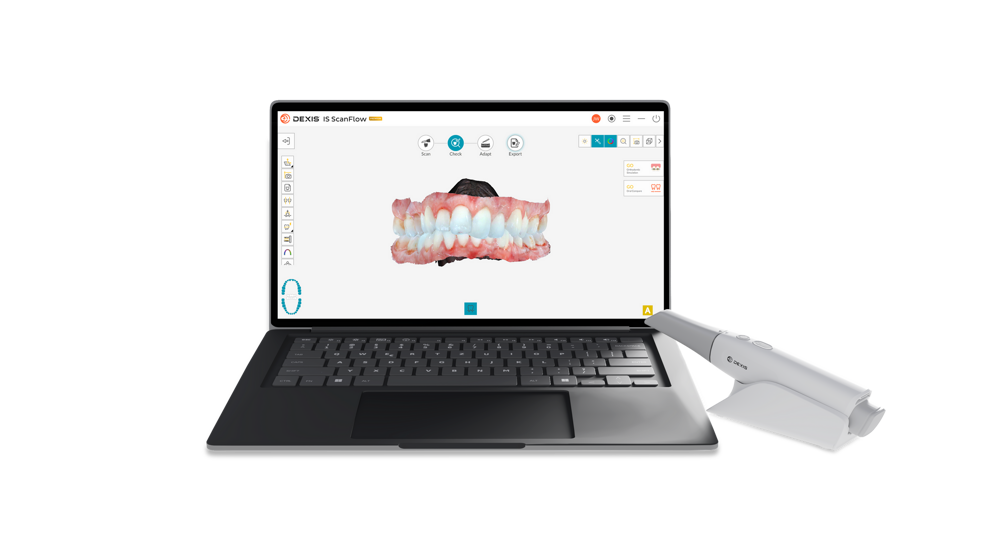 The DEXIS Imprevo intra-oral scanner integrates with DTX Studio Clinic software to support connected digital workflows.
