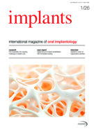 implants international No. 1, 2026