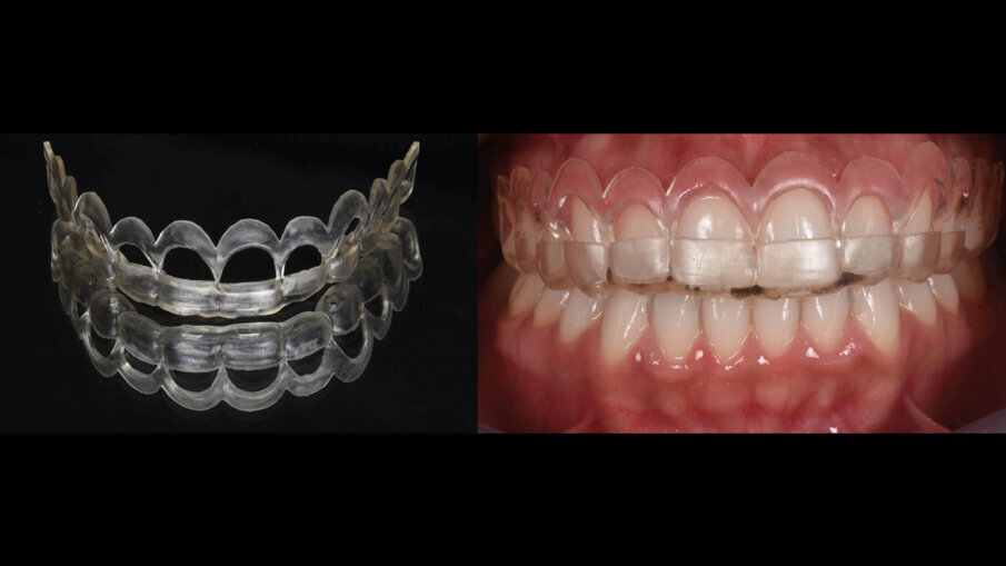 Fig. 11_Prova pre-chirurgica su paziente.