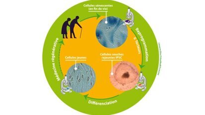 Être jeune éternellement? C'est possible