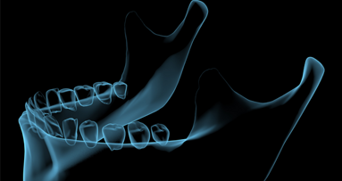Virtuell in Zahn und Kiefer: 7. DDT in Hagen