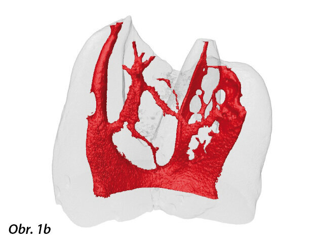 Prostor kořenového kanálku je rozvětvený, plný anastomóz, spletitý jako labyrint, morfologicky srovnatelný s cestami bludiště. Existují primární kanálky, odbočky, vedlejší větve a lumina dentinálních tubulů skrývají rozsáhlou tkáň a mikroflóru.