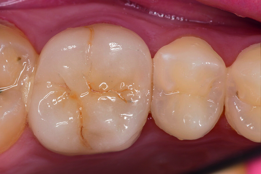 Fig. 13: Final result.