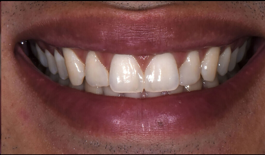 Fig. 21c: Six-month follow-up.