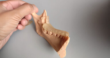 The advantages of digital planning and surgery-first for a better and predictable result in orthognathic surgery