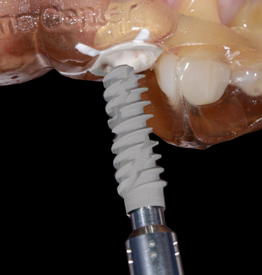 Fig. 27 - Posizionamento impianto 1.2.