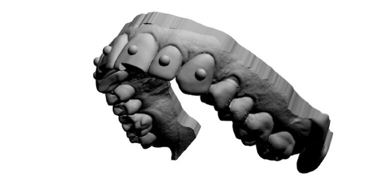 Fig. 16. Wax-up virtual que sigue criterios de la estética maya: borde incisal en incisivos mesial y centrales, reducción del borde incisal en los incisivos laterales e incrustaciones de piedras de canino a canino superior.