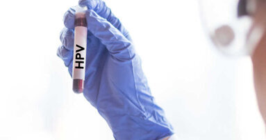 Droga contra o câncer pode ajudar a tratar infecções por papilomavírus humano