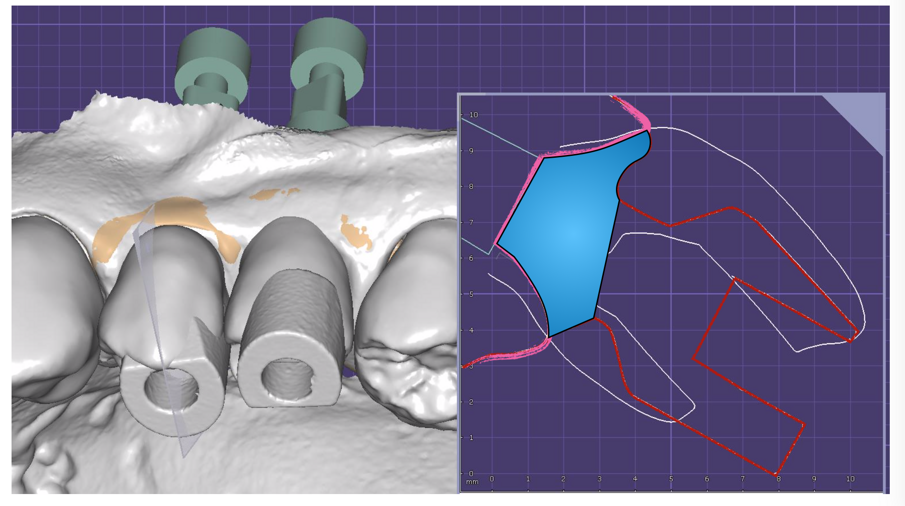 Fig. 8_File CAD derivato dall’unione delle varie scansioni.