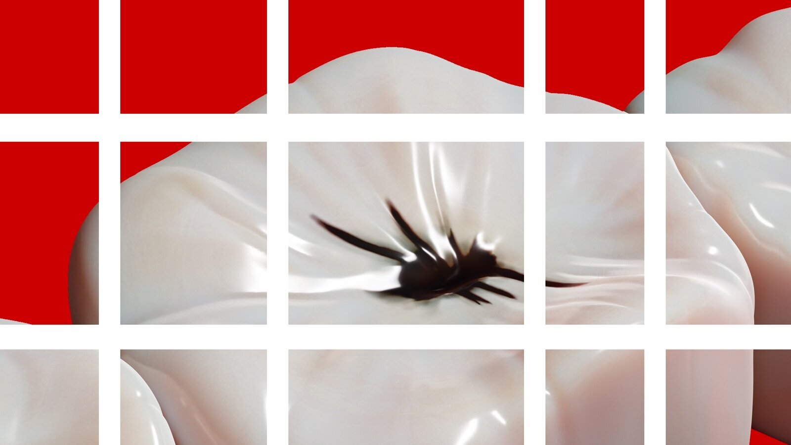 Flúor, pilar fundamental en la Prevención de la Caries y el futuro de la Odontología