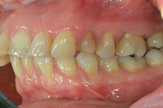 Fig. 1_Il caso iniziale.