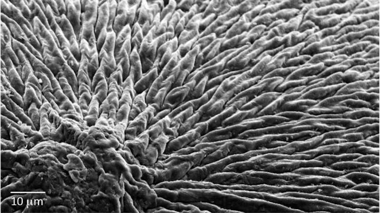 Pesquisadores desenvolvem material que poderia imitar esmalte dentário