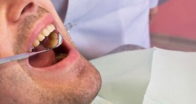 Czym jest starzenie dentalne?