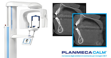 Eccezionale qualità di imaging con le unità CBCT di Planmeca