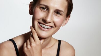 Aparat ortodontyczny – dla zdrowia, nie dla urody