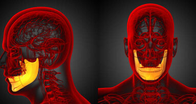 Kraniofaciální chirurgie: Růst individualizovaných kostních implantátů v pacientovi