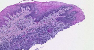 Evaluation of an ex vivo porcine model to  investigate the effect of low abrasive airpolishing