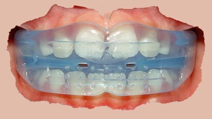 ¿Debe la industria dental determinar el futuro de la Ortodoncia?