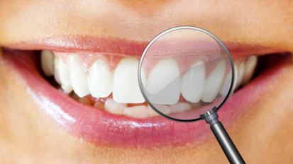 Tag der Zahngesundheit 2015