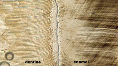 Molars provide insight into evolution of apes, humans