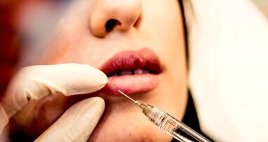 La belleza tiene un precio