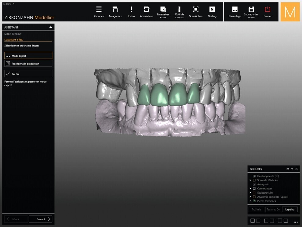 Fig. 6 : Wax-up numérique des couronnes.