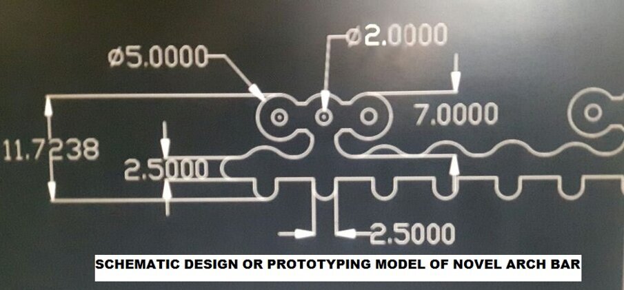 Fig 1: Schematic diagram OR prototyping model of Novel Arch Bar