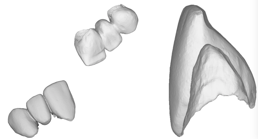 Fig. 22_Scansione extraorale dei provvisori a 360º.