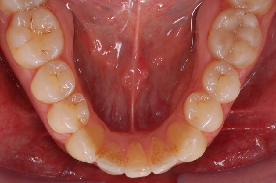 Figg. 51-58_Fotografie facciali e intraorali post-trattamento.