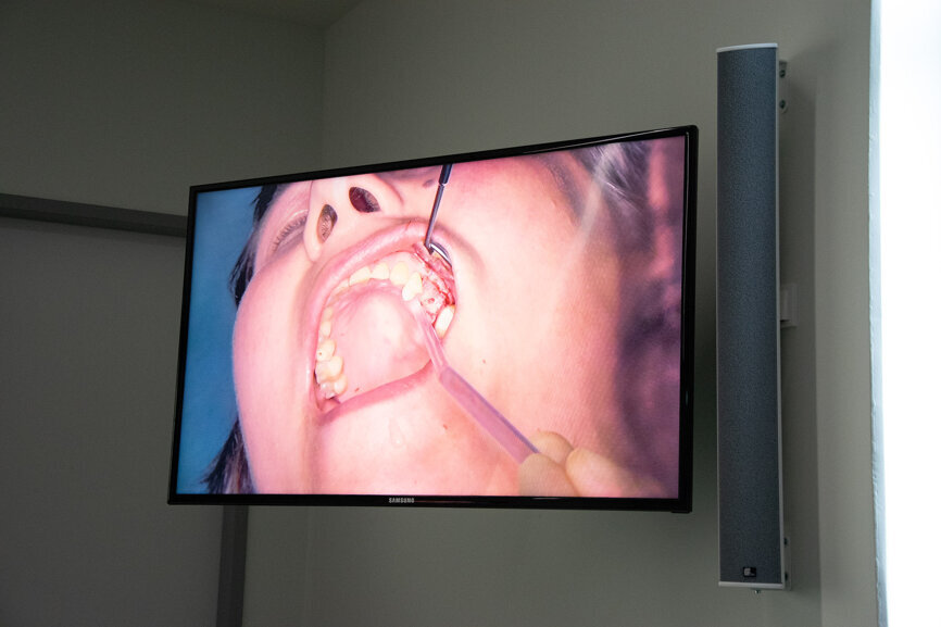 Das durch den Schnitt freigelegte Gewebe näht Wainwright für die Dauer der OP an der Wange fest. Somit würde ein weniger traumatisches Arbeiten ermöglicht und Schwellungen vermieden, erklärt er.  