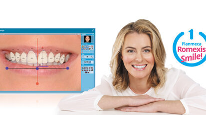 Участвайте в „Усмивка на годината 2015“ и спечелете софтуер за дизайн на усмивката