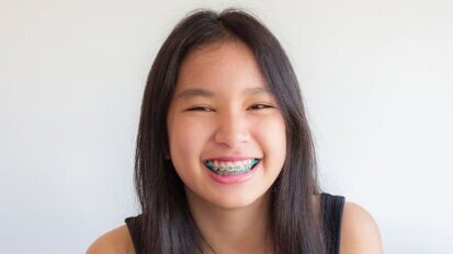 Mercado de suprimentos ortodônticos: Relatório prevê maior taxa de crescimento na região Ásia-Pacífico