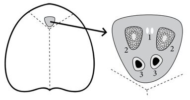 Otwarty przewód nosowo-podniebienny jako przyczyna dolegliwości w przednim odcinku szczęki – przegląd piśmiennictwa