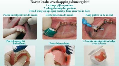 KNMT presenteert praktische hulpmiddelen mondzorg ouderen