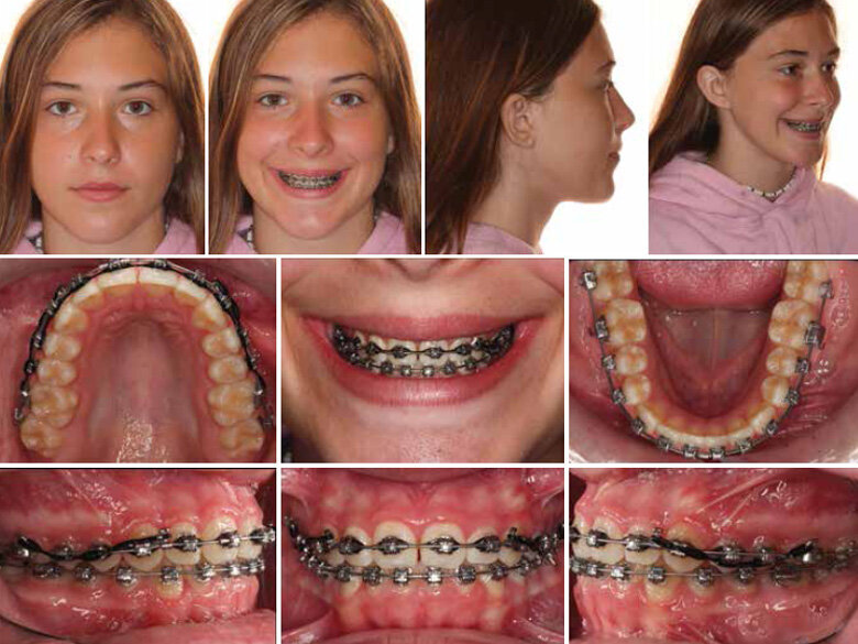 Fig. 1: Initial records. (Photos: Michael J. Mayhew, DDS, MS, MS, & Nicole R. Scheffler, DDS, MS)