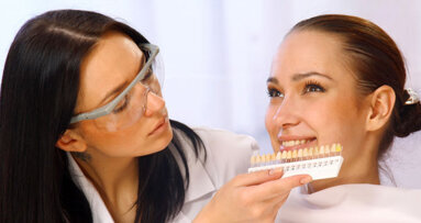 Zahnaufhellung besser nur beim Profi