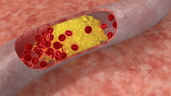 Доброто пародонтално здраве може да намали риска от сърдечносъдови заболявания