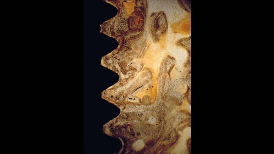 Fig. 7a_Osteointegrazione tra osso e impianto.