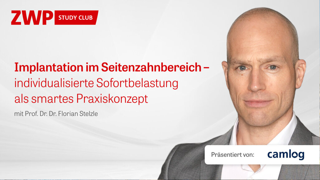 CAMLOG Live-OP am 22. Juni: „Implantation im Seitenzahnbereich”