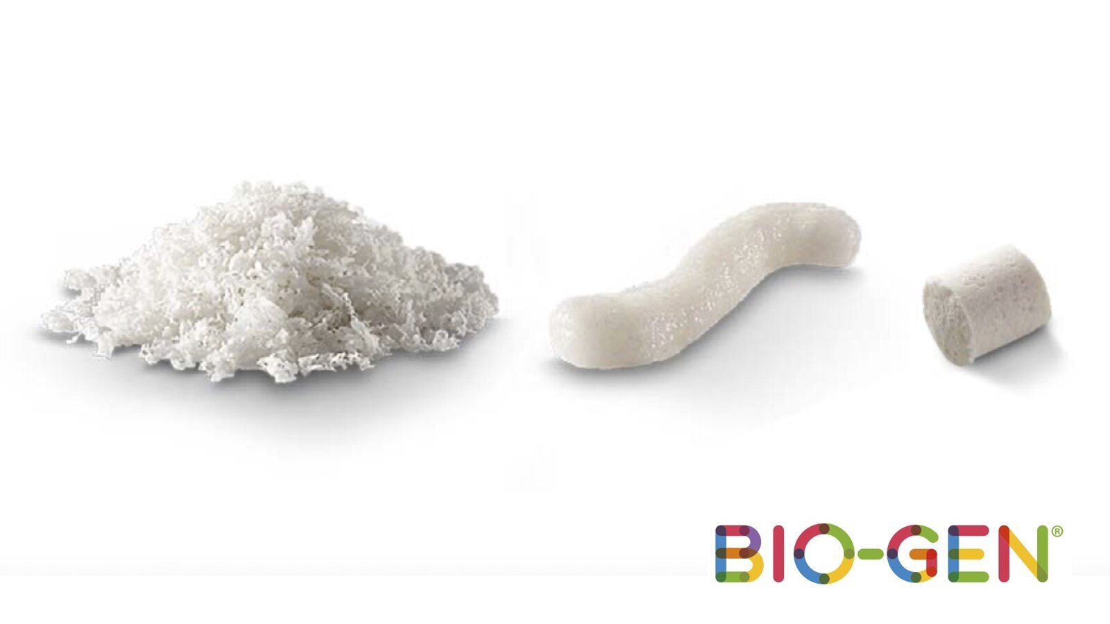 El injerto óseo que remodela el hueso del paciente