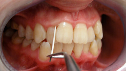Applicazioni della diagnostica molecolare in odontostomatologia