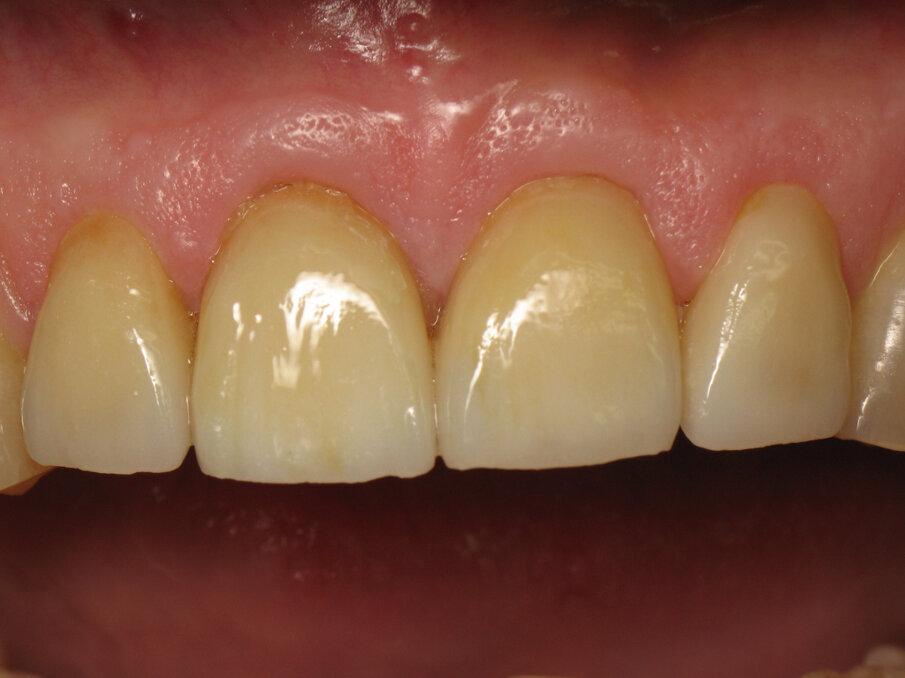 Fig. 2: Close-up of the final situation.