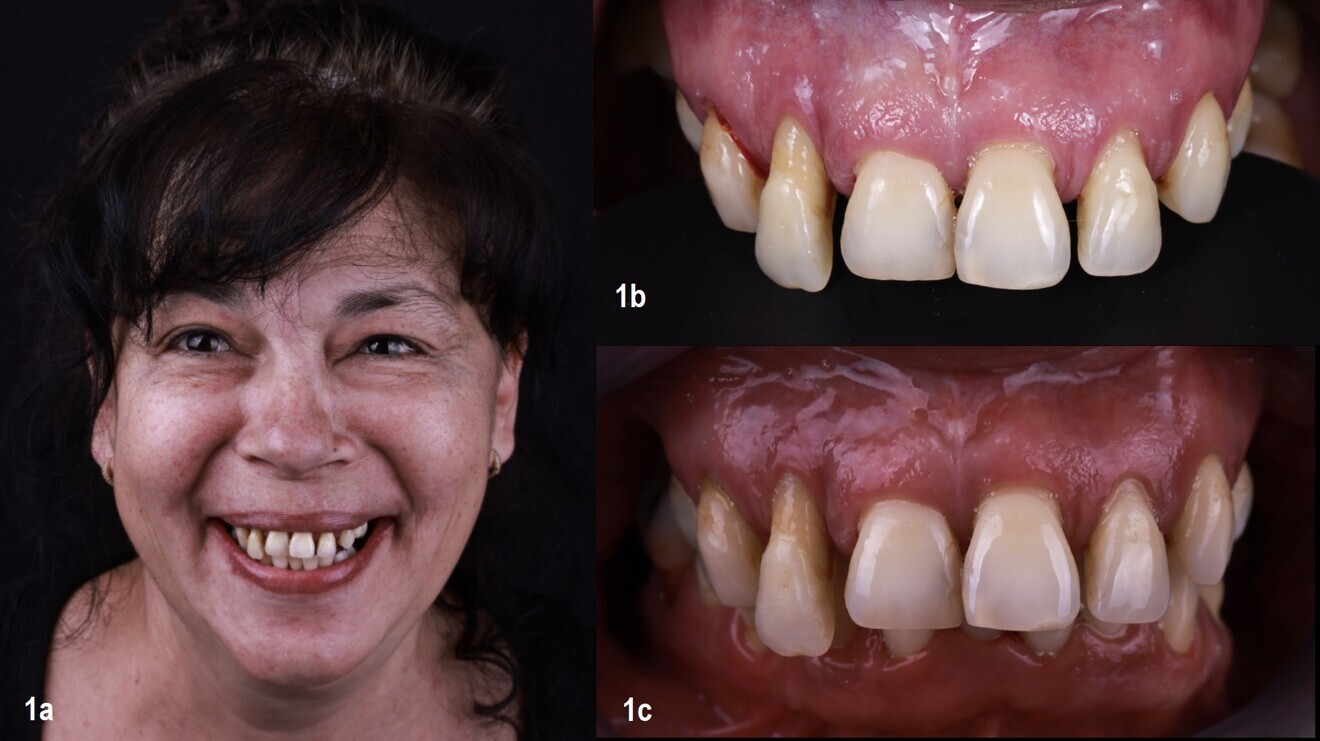 Figs. 1a–c: Initial situation.