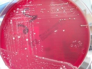 Ryc. 1_Hodowle bakterii, widoczne liczne kolonie bakteryjne
