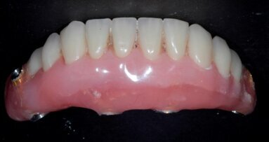 Estetyczna i funkcjonalna rehabilitacja