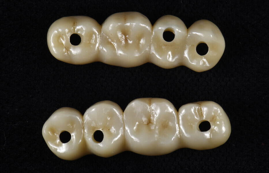 Fig. 16: Final bridges.